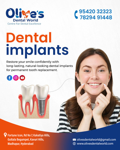 Why Choose Dental Implants for Long Lasting Support?.jpg