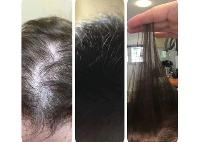 Complete Guide to Managing Hair Loss and Scalp Conditions.jpg