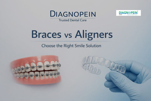 Dental Braces (14).jpg