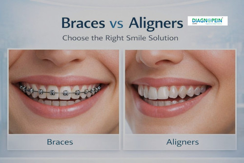 Dental Braces (15).jpg