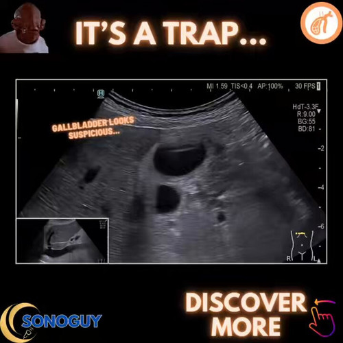 g6NcNltiG 49Mn1Y.jpg