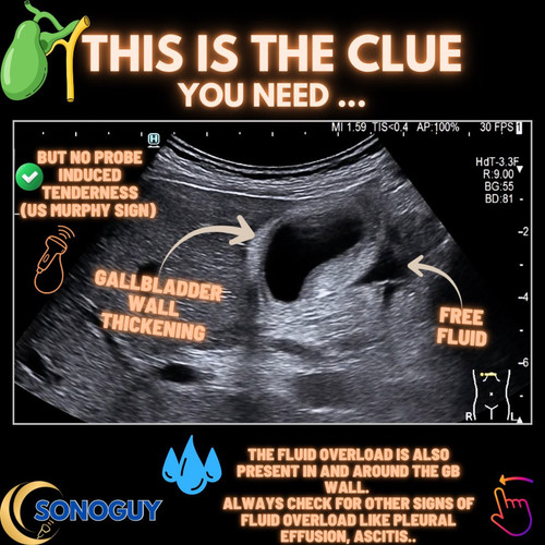 G XKpJxWQAAHpNr?format=jpg.jpg