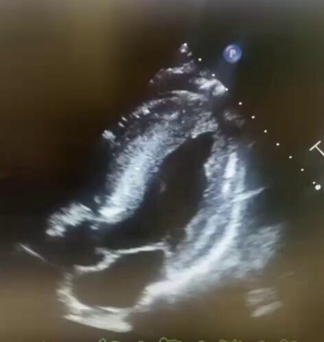 2Nc lylfpr8jTu1x.jpg