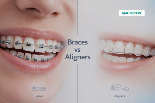 Dental Braces (17).jpg
