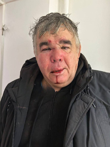 NXSkBYQT9ZCtzm edP4KObTUnNgqx 6pHkdmlid5aiUrwSBgNnAXfZjZIF 9hOmCRpa 36Bf24ZZl8LMxePdgOTMvf1D9BZKDG0f.jpg