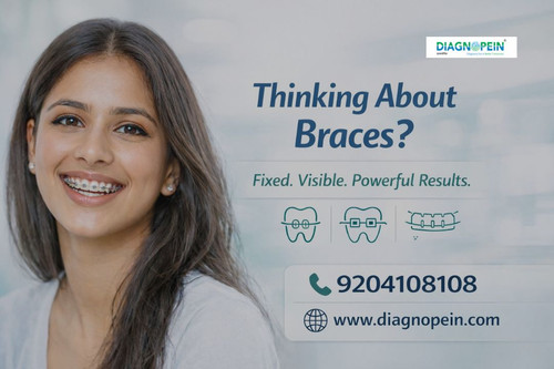 Dental Braces (12).jpg