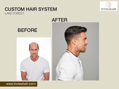 Custom Hair System Lake Forest.jpg