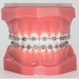 Braces Fishers.png