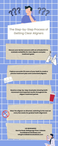 The Step-by-Step Process of Getting Clear Aligners.jpg