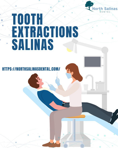 Safe Tooth Extractions Salinas Services For All Ages.jpg