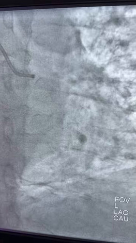 bJG17t 0P96N6cay.jpg