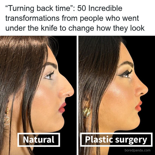 plastic surgery transformations.jpg
