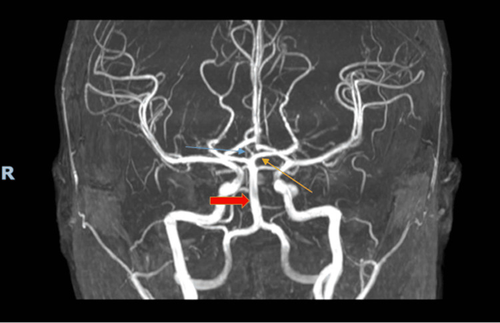 G NJuX7WkAIwtR4?format=png.png