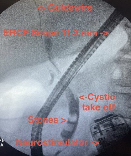 G ZBlofWMAAbfcy?format=jpg.jpg