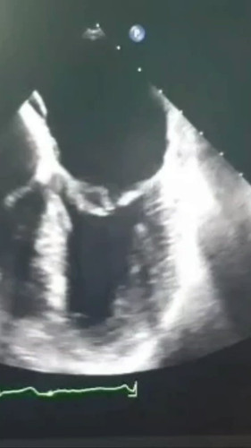 JM 67JFkX28aZY m.jpg