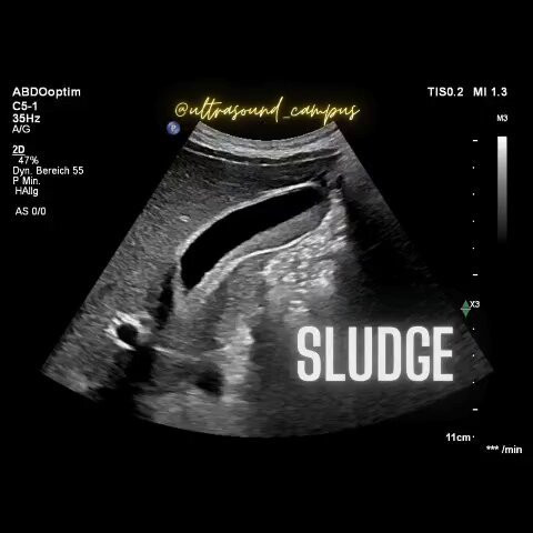 dasvPI34BF2 SHKd.jpg