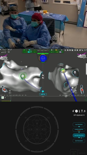 y H9T94ihS8 MpZu.jpg