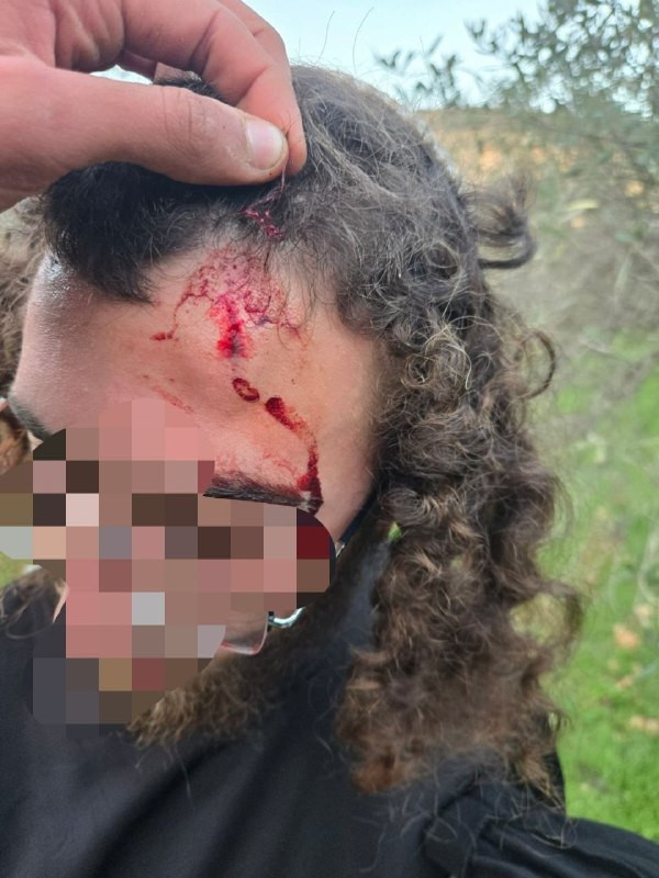 مصادر عبرية: مستوطن مصاب بحجارة شاب أثناء اعتداء مستوطنين على فلسطينيين في الضفة الغربية....