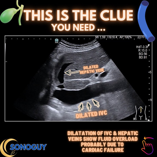 G XKpJsW4AEk4 B?format=jpg.jpg