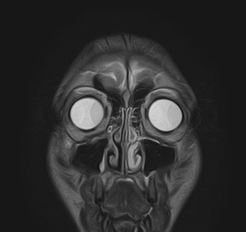 G ZmqKGbgAELn13?format=jpg.jpg