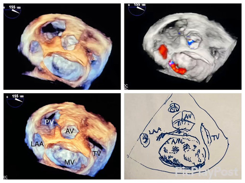 nVvF6x NUKni8wNb.jpg