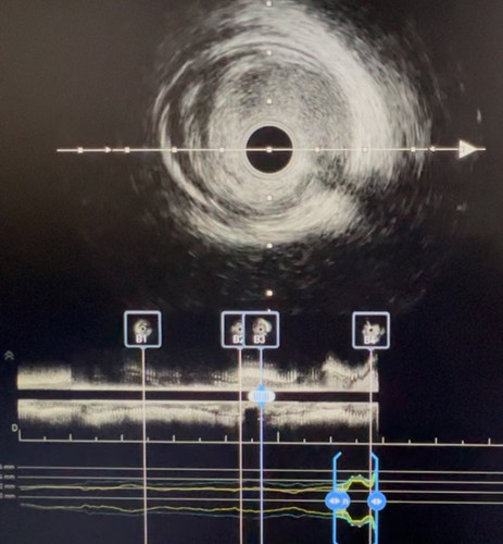 G c8ccnWsAA0TFA?format=jpg.jpg