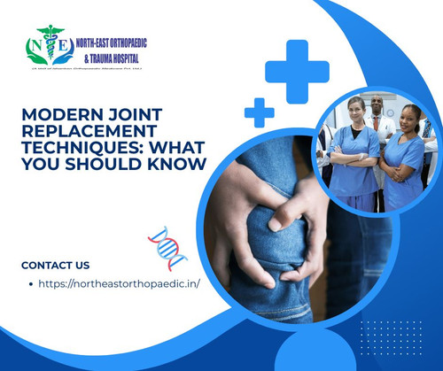 Modern Joint Replacement Techniques What You Should Know.jpg