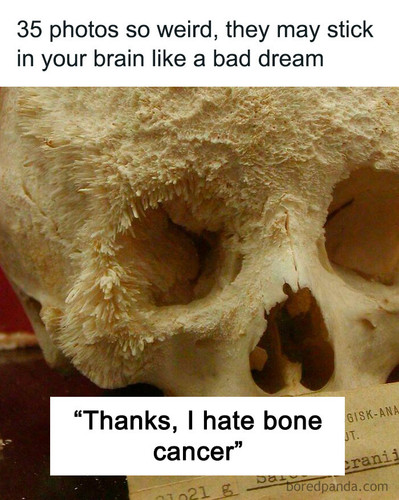 2sizqSR.jpg