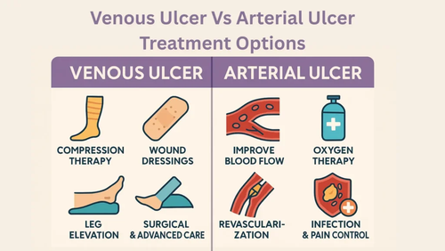 Venous Ulcer Vs Arterial Ulcer Treatment Options.png