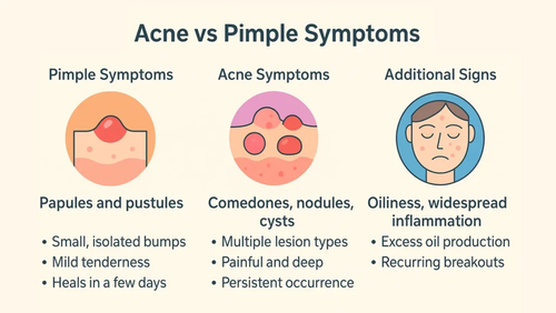 Acne Vs Pimple Symptoms:.png