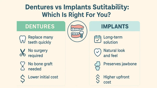 Dentures Vs Implants Suitability: Which Is Right For You?.png