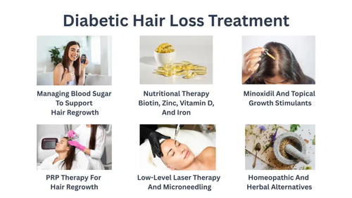 Diabetic Hair Loss Treatment.png