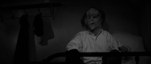 The.Elephant.Man.1980.2160p.UHD.BluRay.CZ EN.FLAC.2.0.DoVi.HDR.x265 E.mkv 20251212 191731.429.jpg