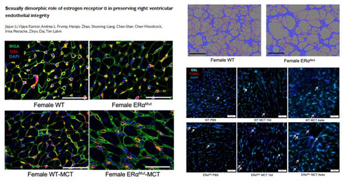 G fDgxcXIAAXzaX?format=jpg.jpg