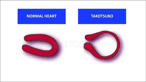 1WVE7CYTzkg K39t.jpg