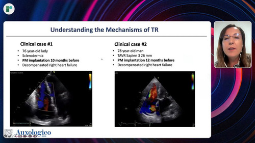 W GxEN3nkl9QWB2m.jpg