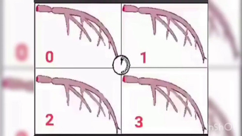 BUfAm a3KGTGhiPC.jpg