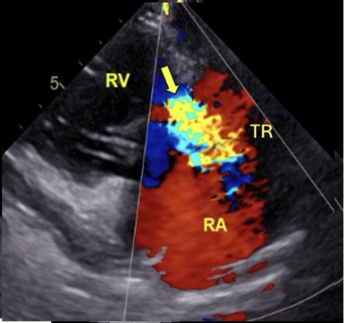 G f1s7WXoAE530R?format=jpg.jpg