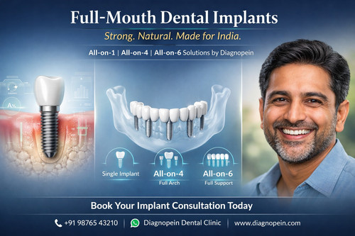 Dental Implant.jpg