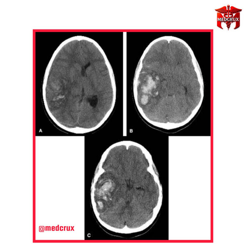 G miv55W4AA FHw?format=jpg.jpg