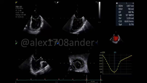 qZmIZYlFeY9VfET .jpg