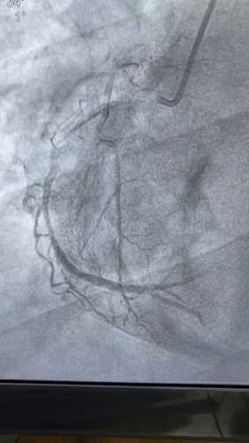 vqZT0 bq0fFNMlmD.jpg