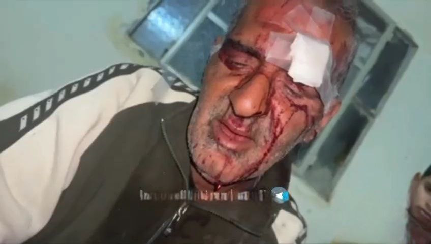 جنود الاحتلال يعتدون على الفلسطيني خالد مشعل الكلوني من مخيم عين السلطان شمال مدينة أريحا بالضرب المبرح أثناء اعتقاله....