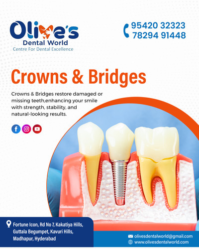 Why are Crowns & Bridges Key for Smile and Bite Repair?.jpg