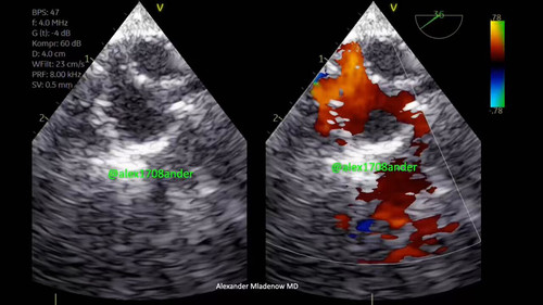 UCHXxfj gLMPc8yK.jpg