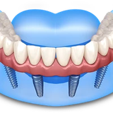 denture repair