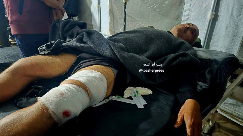 مصابون في بينهم أطفال بعد انفجار قنبلة من مسيرة "إسرائيلية" على خيمة للنازحين في محيط مسجد العمري الكبير، بمدينة غزة...