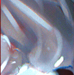 w1.gif