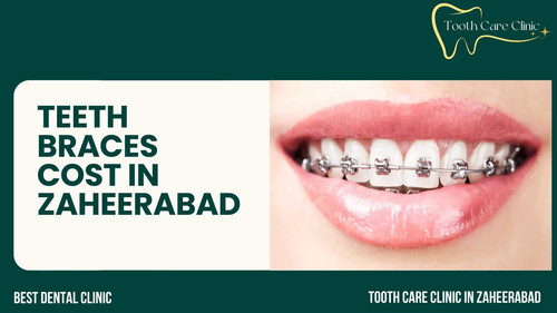 tooth care (7).jpg