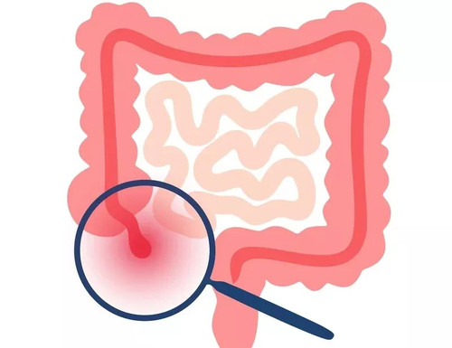 Appendix Treatment in Indore.jpg